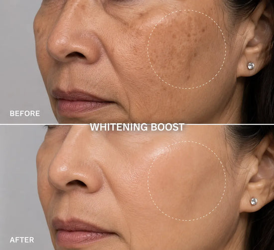 Whitening Boost GLEYSY 5x10ml - Dépigmentant Concentré GLEYSY Anti-tâches /dépigmentation