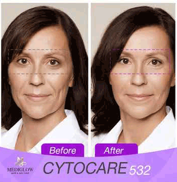 Cytocare Haut-Booster